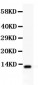 Anti-TFF1 Picoband Antibody